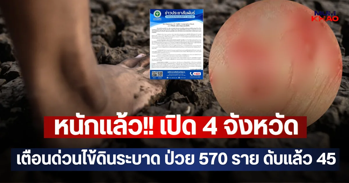 หนักแล้ว!! เปิด 4 จังหวัด เตือนด่วนไข้ดินระบาด ป่วย 570 ราย ดับแล้ว 45